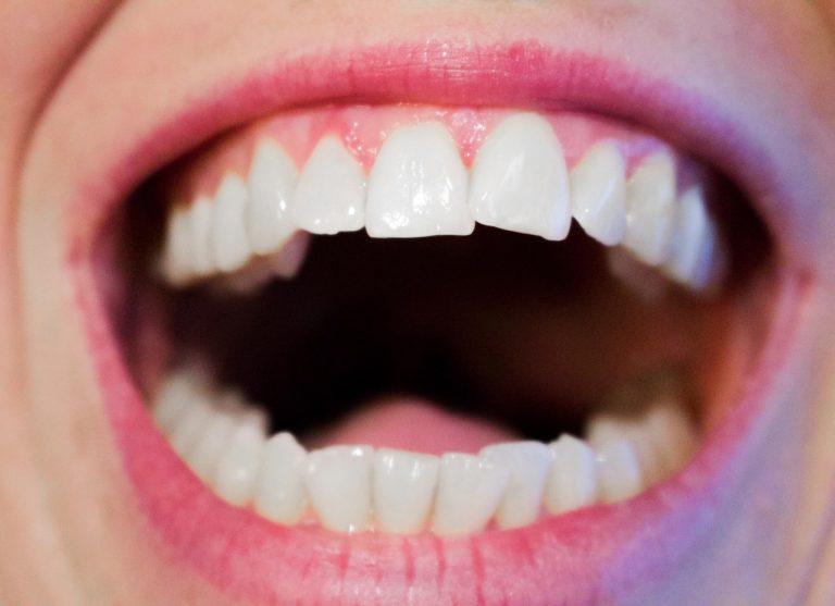 Dzisiejsza technika używana w salonach stomatologii estetycznej być może spowodować, że odzyskamy śliczny uśmiech.